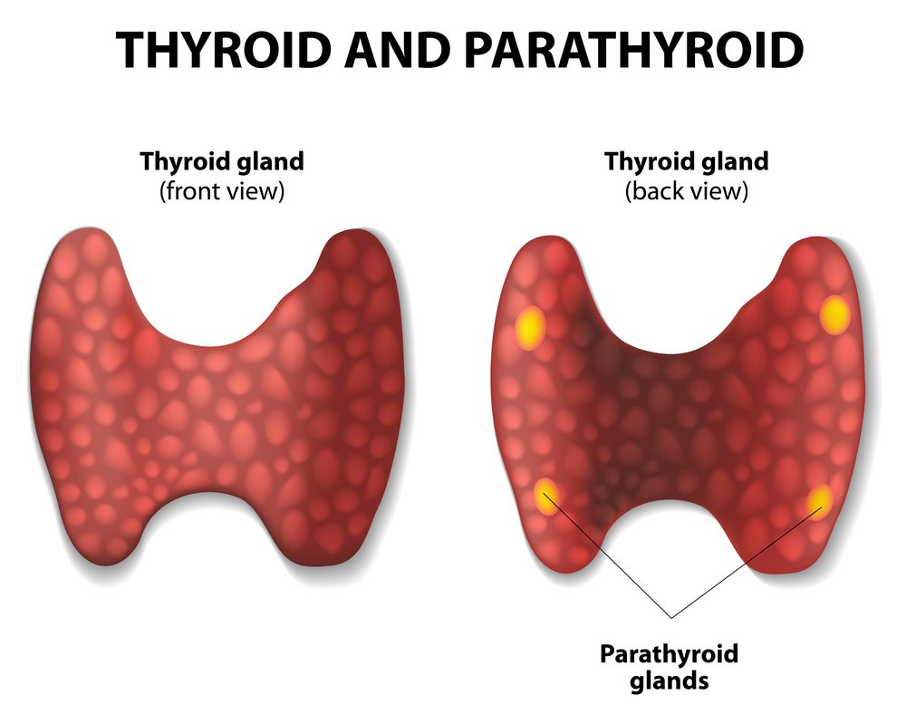 Hyperparathyroidism Overview Causes Symptoms Treatment Illness