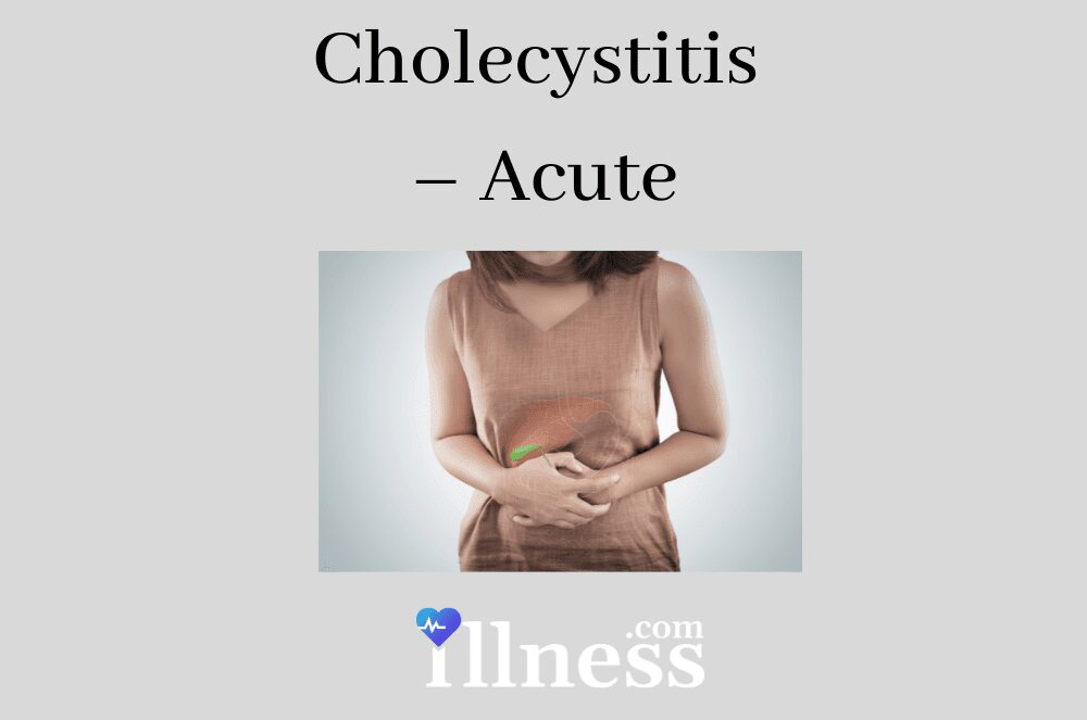 Cholecystitis Acute Overview Causes Symptoms Treatment