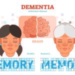 Dementia And Alzheimer’s