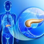 Pancreatic Islet Cell Tumors