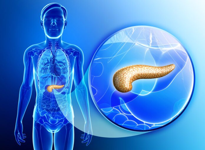 Pancreatic Islet Cell Tumors