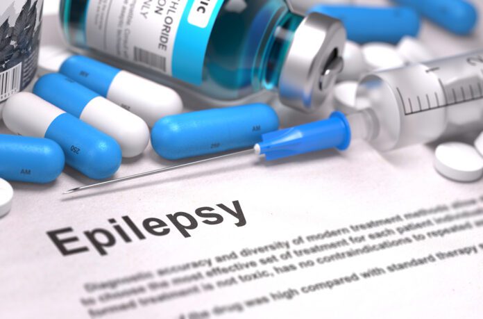 Epilepsy