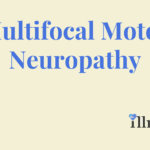 Multifocal Motor Neuropathy