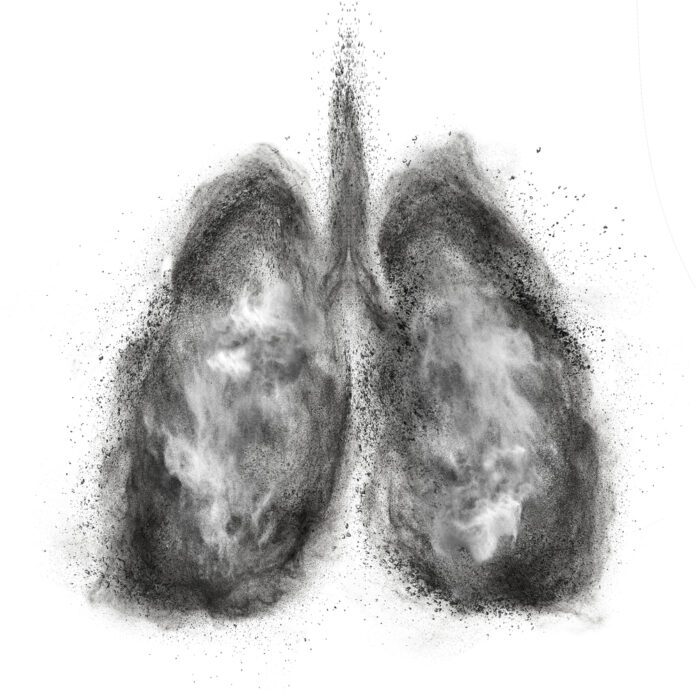 Black Lung Disease