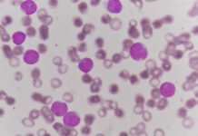 Chronic Myeloid Leukemia | Illness.com