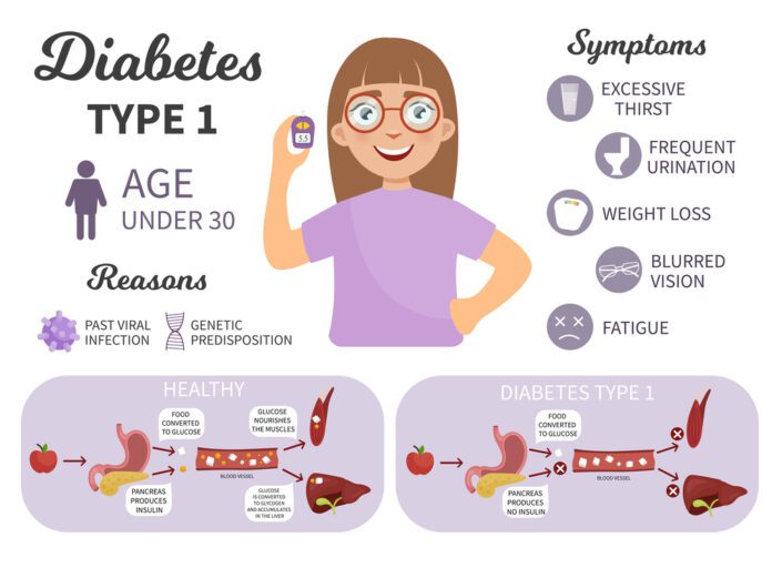 Autoimmune Diabetes