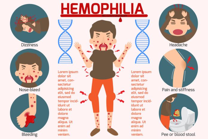 Hemophilia B