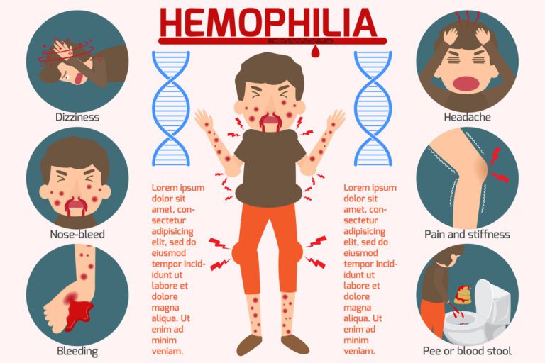 Bleeding Disorder - Hemophilia B | Illness.com