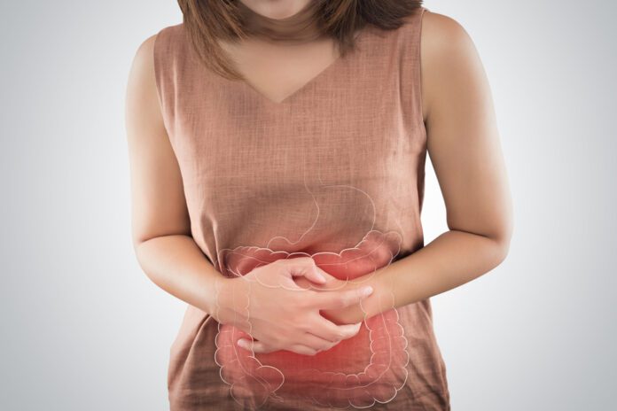 Irritable Bowel Syndrome (IBS)