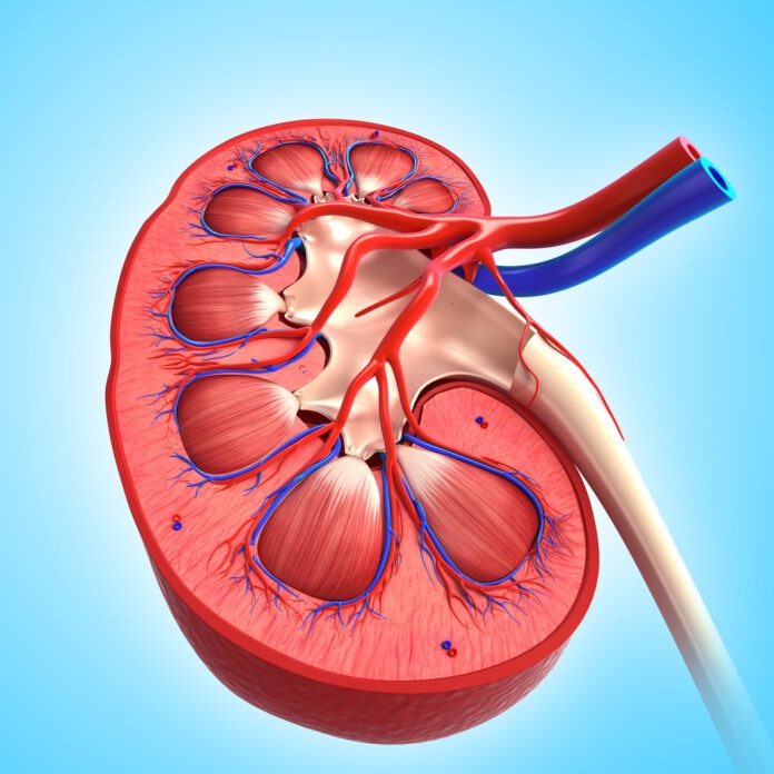 IgA Nephropathy