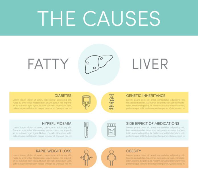 Nonalcoholic Fatty Liver Disease