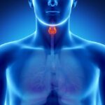 Hyperthyroidism