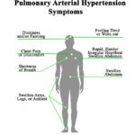 Pulmonary Arterial Hypertension