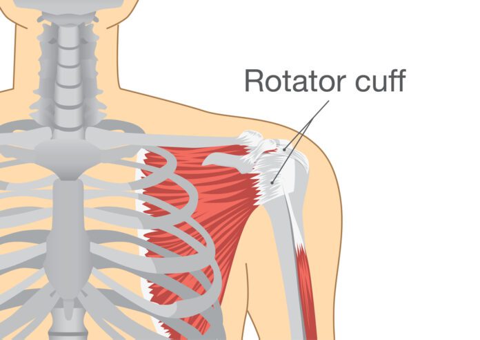 Rotator Cuff Tendinitis