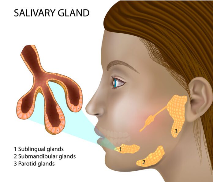 Salivary Gland Infection