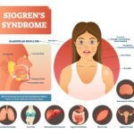 Sjogren's Syndrome