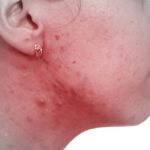 Skin Problems & Treatments