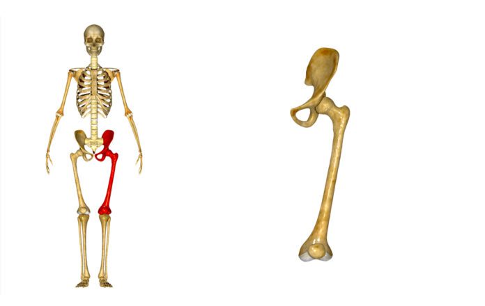 Femoral Epiphysis – Slipped