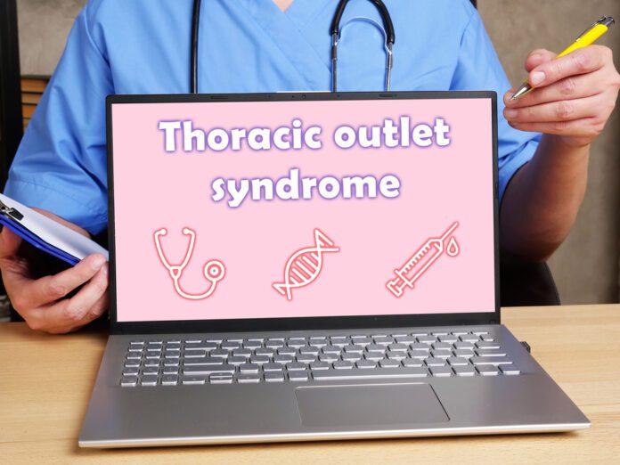 Thoracic Outlet Syndrome