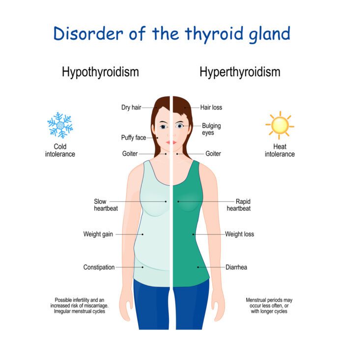 Thyroid Disorders