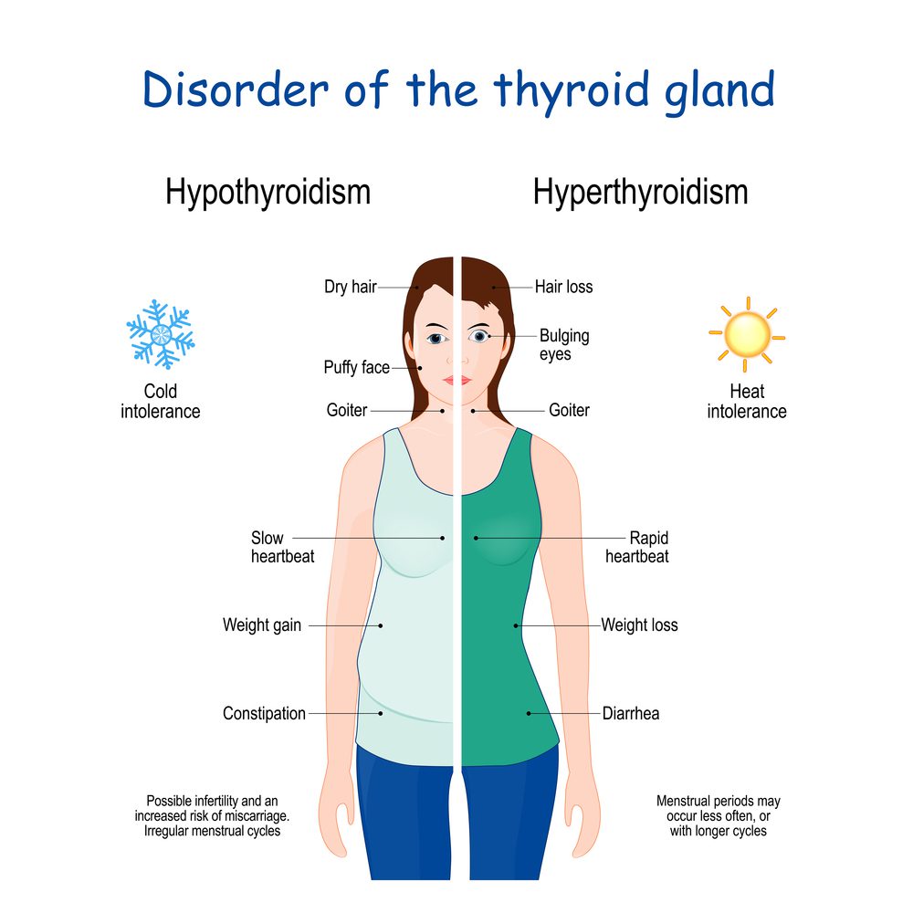 non thyroid illness syndrome