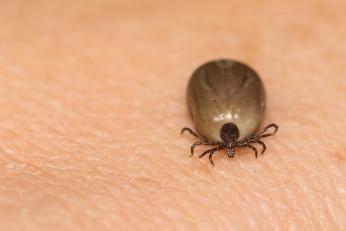 Tick Removal