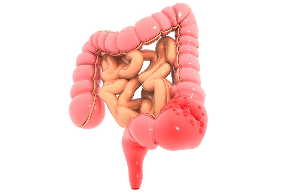 Virtual Colonoscopy Illness