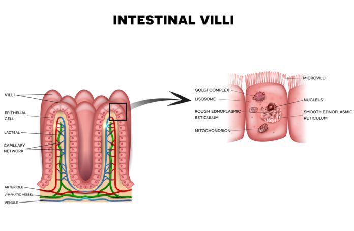 Whipple's Disease