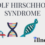 Wolf Hirschhorn Syndrome