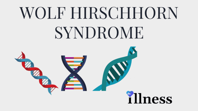 Wolf Hirschhorn Syndrome