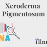 Xeroderma Pigmentosum