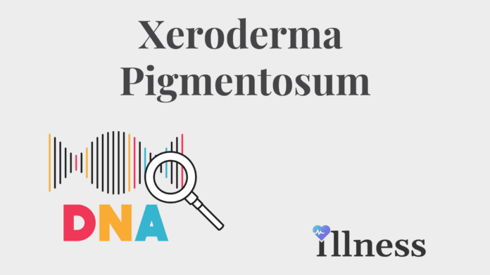 Xeroderma Pigmentosum