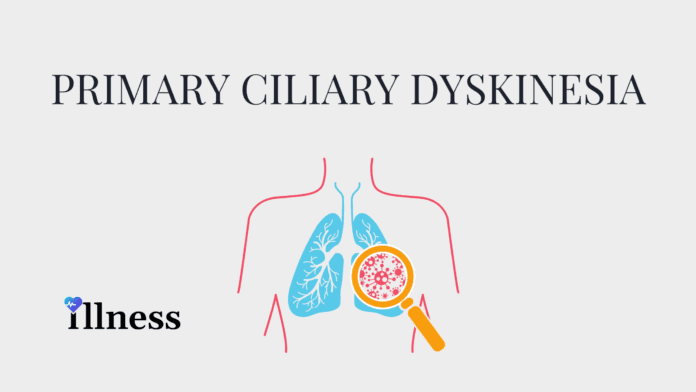 Primary Ciliary Dyskinesia