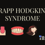 Rapp Hodgkin Syndrome