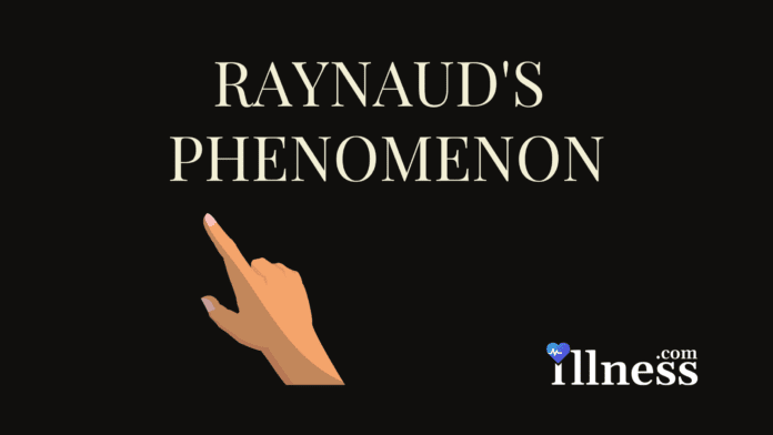 Raynaud's Disease