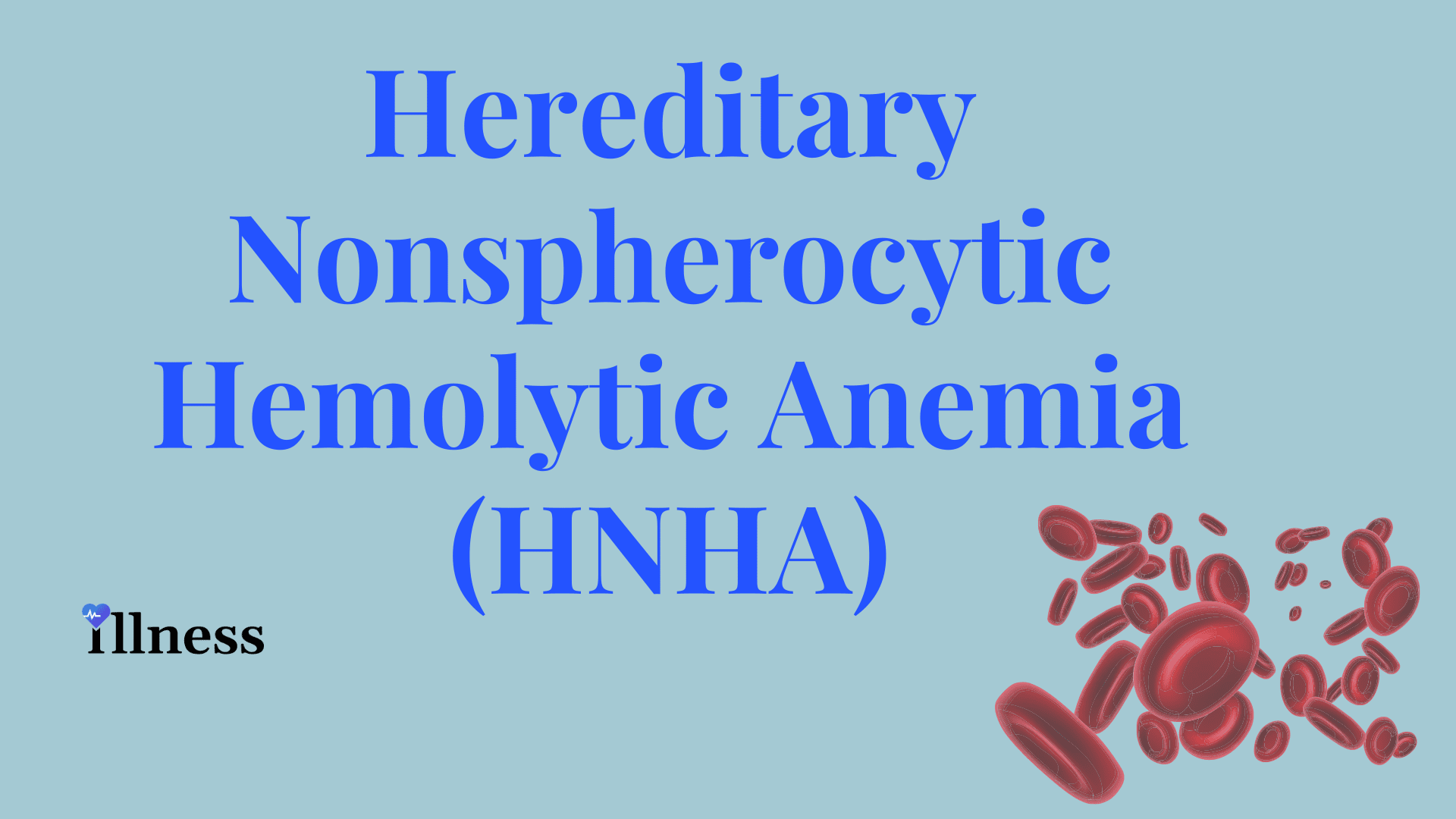 Hemolytic Anemia Spherocytic