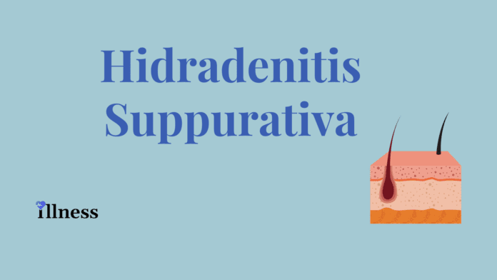 Hidradenitis Suppurativa