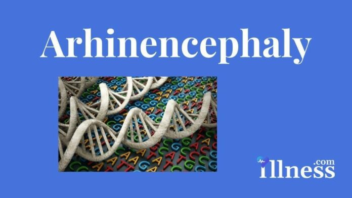 Arhinencephaly