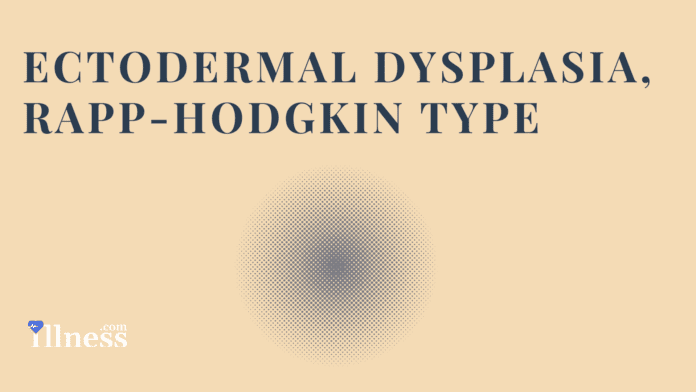 Ectodermal Dysplasia, Rapp-Hodgkin Type