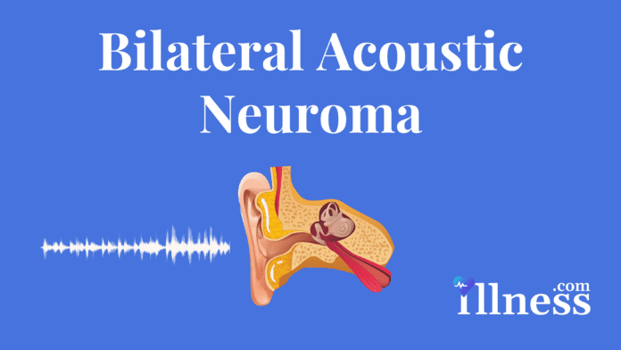 Bilateral Acoustic Neuroma