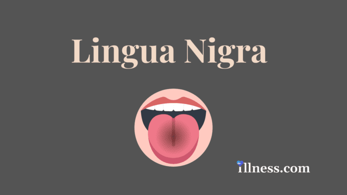 Lingua Nigra