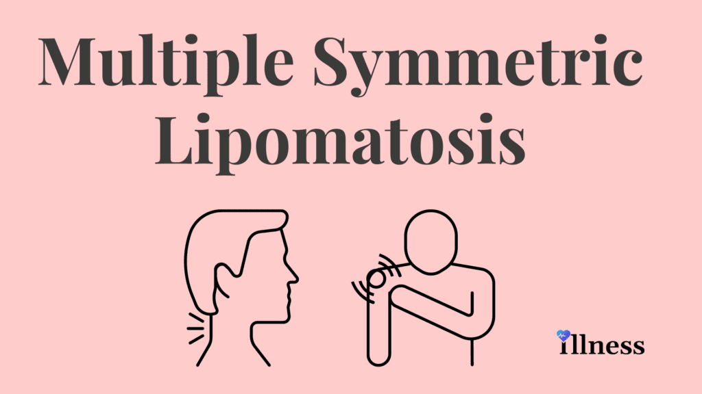 Multiple Symmetric Lipomatosis Overview Causes Symptoms Treatment