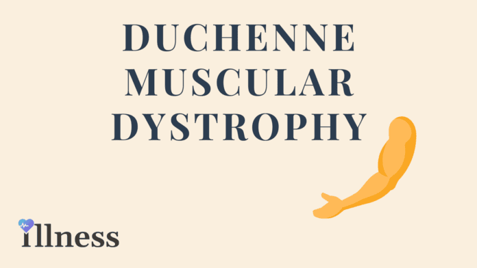 Duchenne Muscular Dystrophy