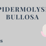 Epidermolysis Bullosa