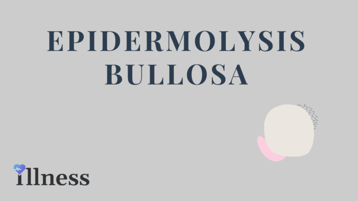 Epidermolysis Bullosa