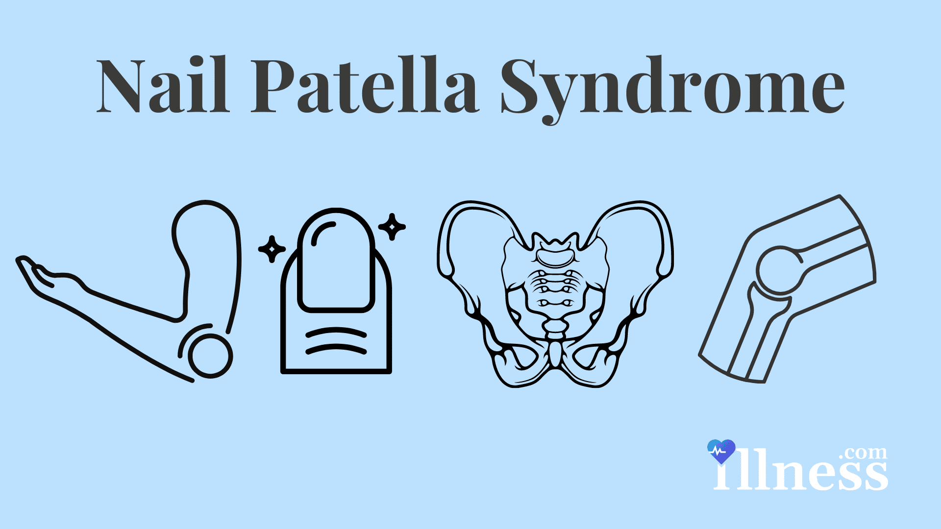 PDF) The small patella syndrome: Description of five cases from three  families and examination of possible allelism with familial patella  aplasia-hypoplasia and nail-patella syndrome [11]