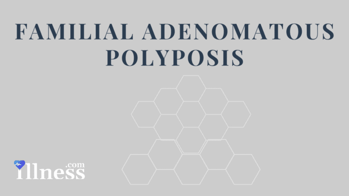 Familial Adenomatous Polyposis