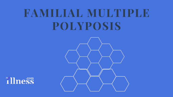 Familial Multiple Polyposis