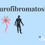 Neurofibromatosis