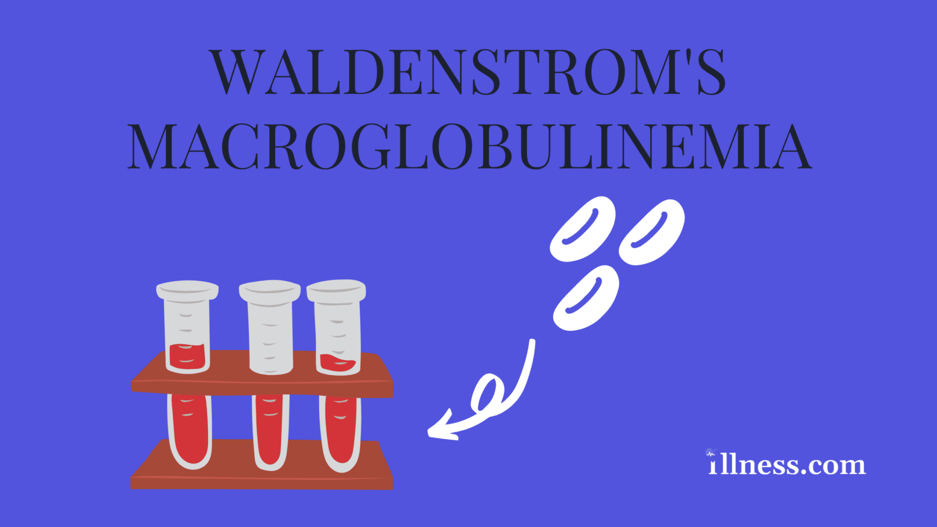 Waldenström Macroglobulinemia : Overview, Causes, Symptoms, Treatment ...
